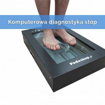 Czym jest komputerowa diagnostyka stóp?